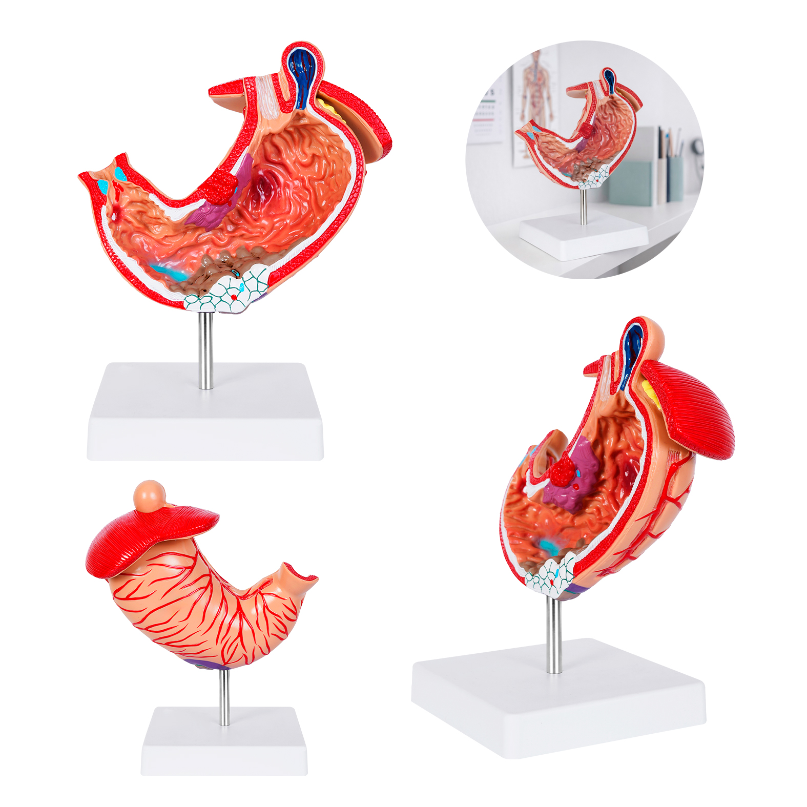 Gastro CP 160